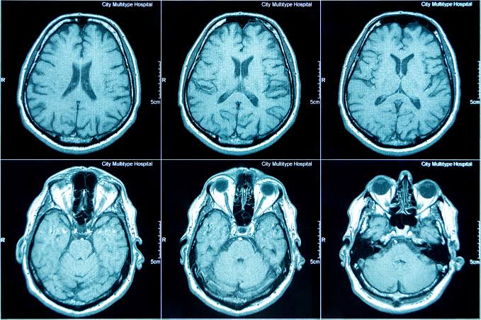 ct scan